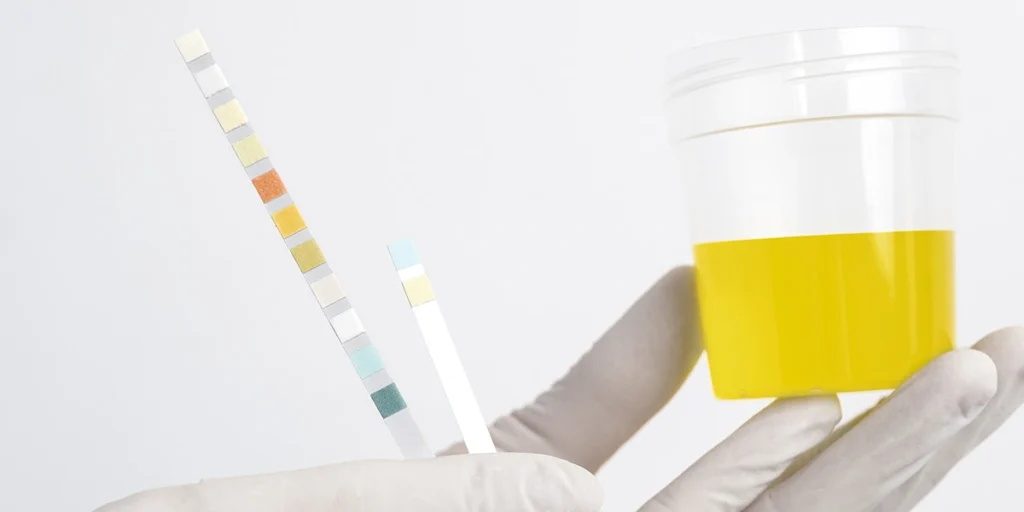 urine drug test