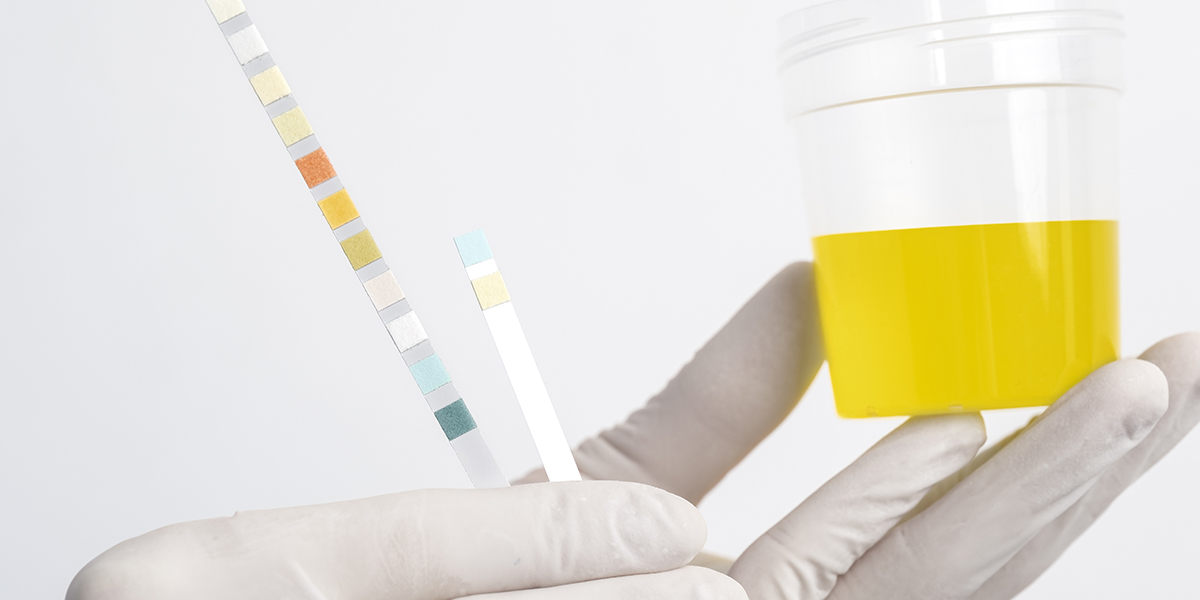 how to pass a dot physical urine test